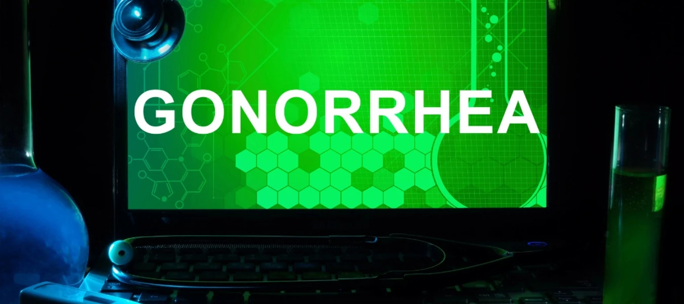 Orlando, Florida Gonorrhea testing.